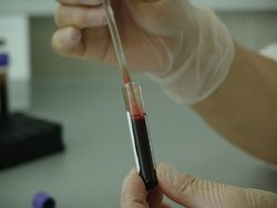 Coronavirus testing